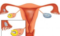 Фото: Лютеиновая фаза менструального цикла