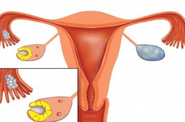 Фото: Лютеиновая фаза менструального цикла
