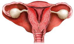 Фото: Эндометрит матки у женщин