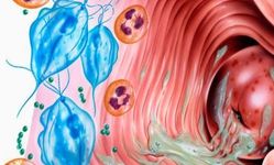 Фото: Вагинит