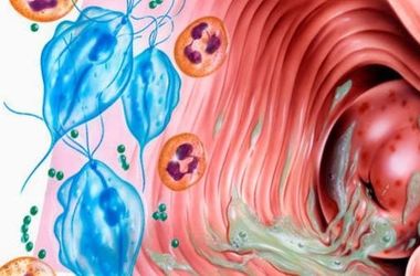 Фото: Вагинит