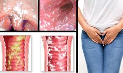 Фото: Вагинит при беременности